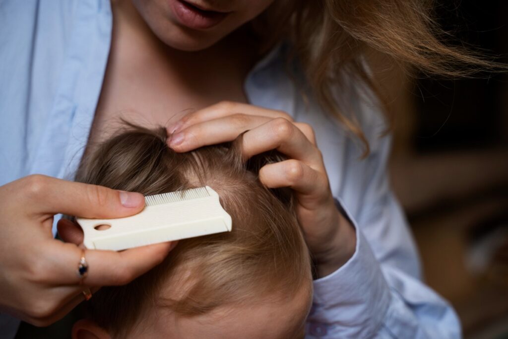 Além de utilizar loções e shampoos específicos, o uso do pente fino é uma técnica importante no combate aos piolhos. Imagem: Freepik