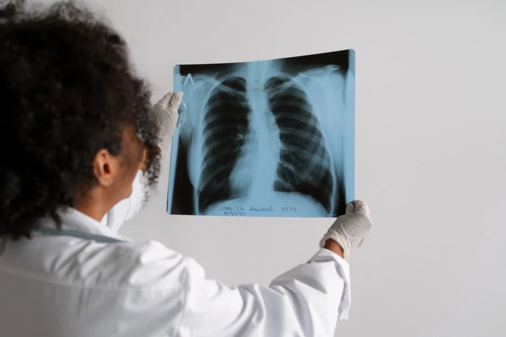 Médico examinando radiografia de tórax, com foco em pulmões, para diagnóstico de pneumonia silenciosa.